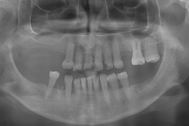 Radiografie pacient cubicdent Bucuresti sector 2 Radiografie pacient cubicdent Bucuresti sector 2 Radiografie dentara