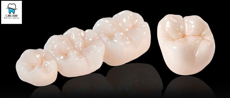 Cele mai importante 7 lucruri pe care trebuie sa le cunosti despre coroanele dentare Coroane dentare ceramice zirconiu