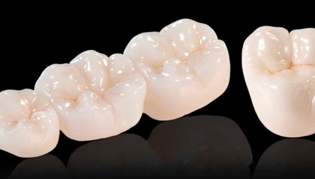 coroana dentara ceramice zirconiu bucuresti sector 2 coroana dentara ceramice zirconiu bucuresti sector 2