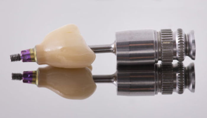 Implant dentar bucuresti cabinet stomatologic sector 2 Bucuresti ps Implant dentar bucuresti cabinet stomatologic sector 2 Bucuresti ps