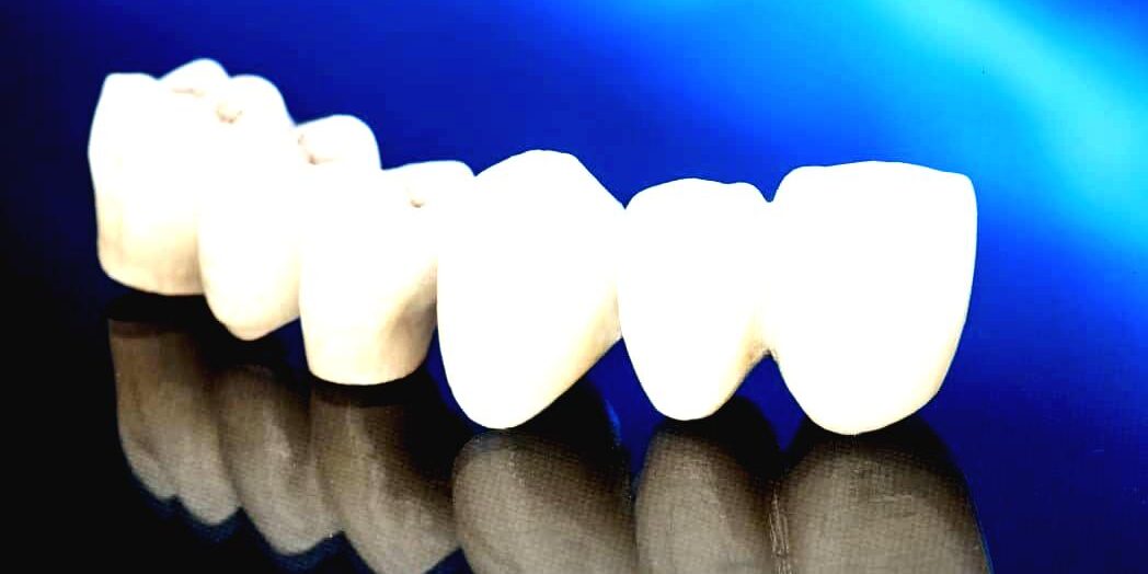 coroane dentare – punte dentara punte dentara zirconiu