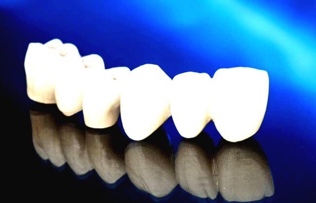 coroane dentare – punte dentara punte dentara zirconiu