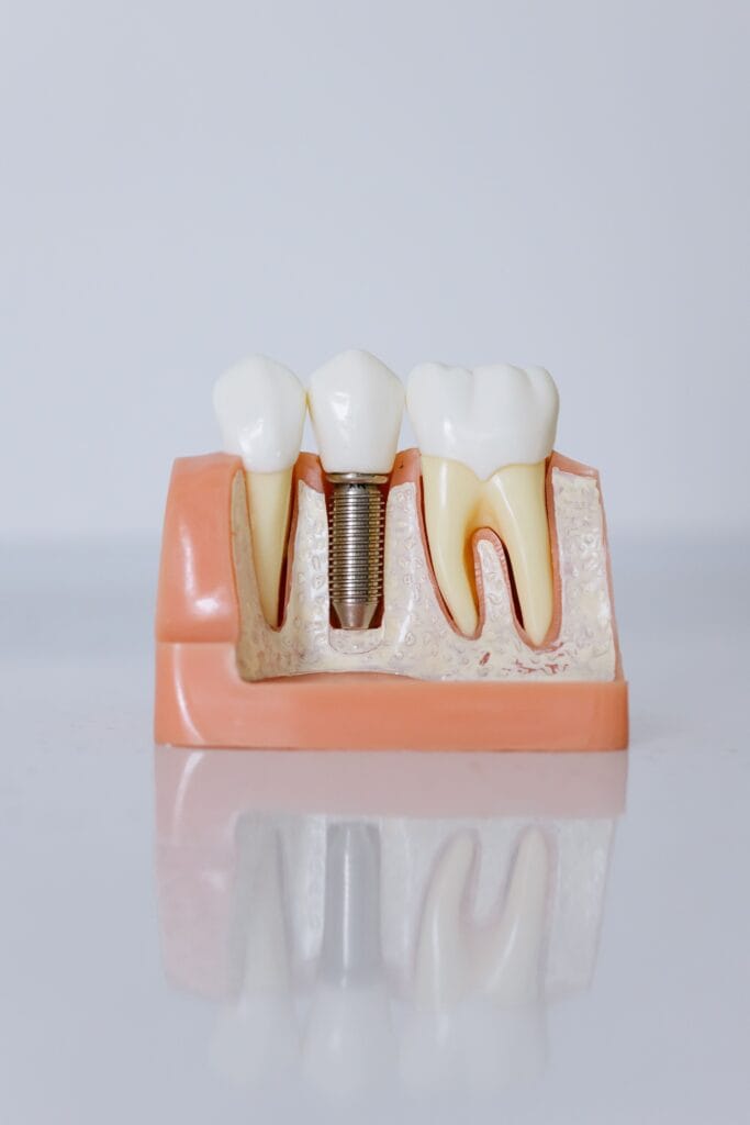 implant.articol