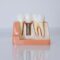 implant.articol