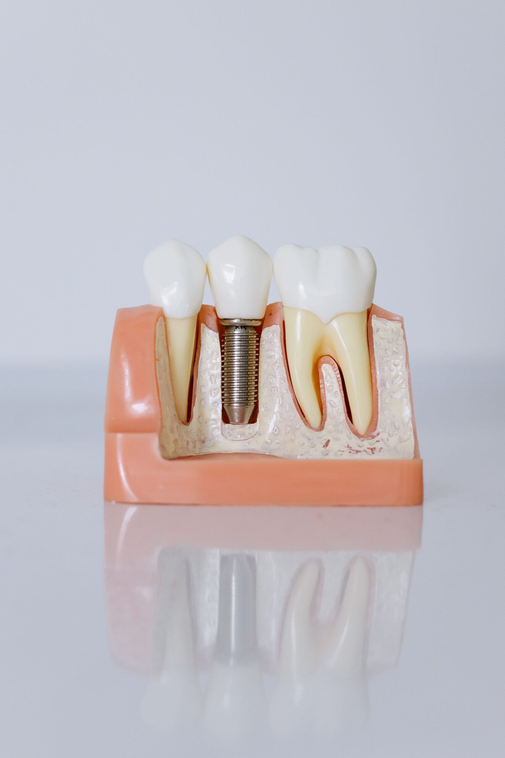 implant.articol